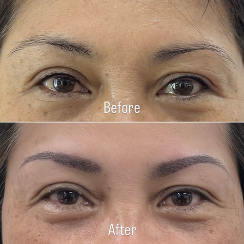 Brow before and after