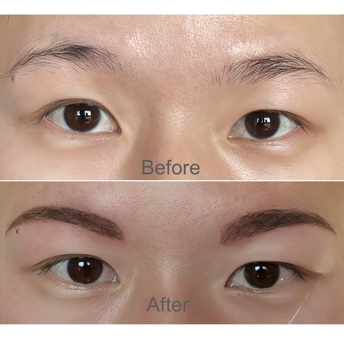Brow before and after