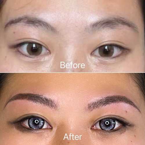 Brow before and after