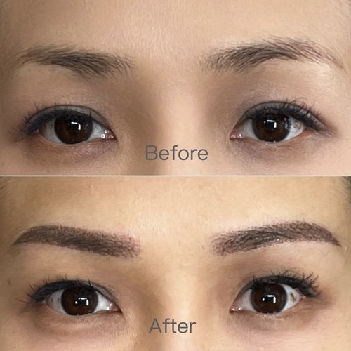 Brow before and after