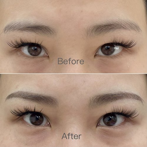 Brow before and after